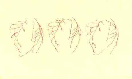 heartvessles.jpg